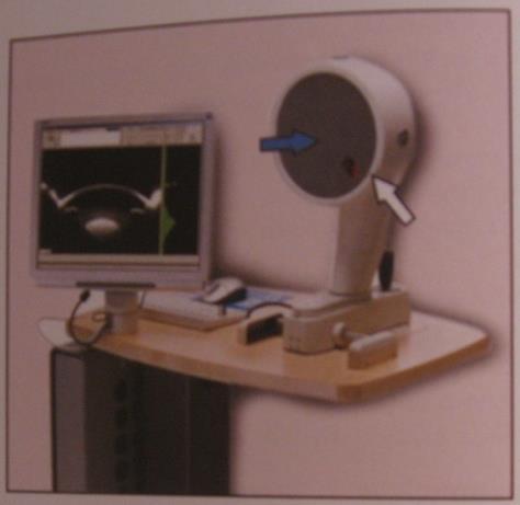 Εικόνα 2.1: Υπολογιστική Βιντεοκερατοσκοπία βασιζόμενη σε κώνο Placido.