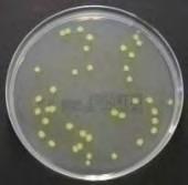 Εικόνα 2.1 Pseudomonas spp. (http 7) Η φρεσκότητα των καρκινοειδών είναι το πιο σημαντικό κριτήριο κατά την αξιολόγηση της ποιότητας.