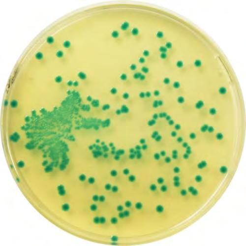 Εικόνα 3.3. Listeria spp. καλλιεργημένη σε τρυβλίο Petri (http 7) 3.4 Staphylococcus aureus To Staphylococcus aureus δεν είναι παθογόνος που σχετίζεται με την μικροβιακή χλωρίδα των καρκινοειδών.