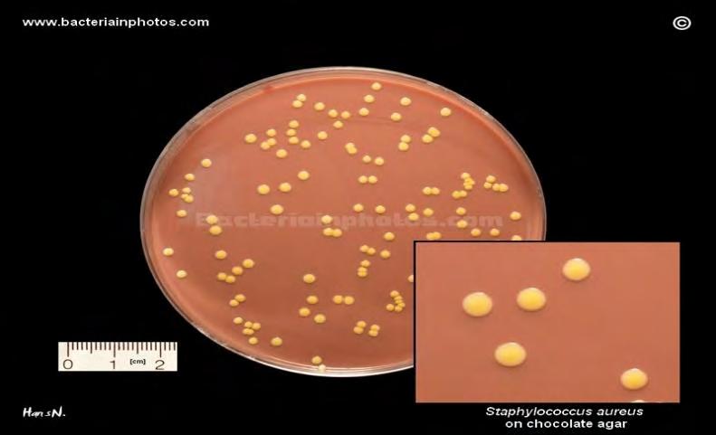 Εικόνα3.4. Staphylococcus aureus καλλιεργημένο σε τρυβλίο Petri 3.5 Clostridium botulinum Το C.