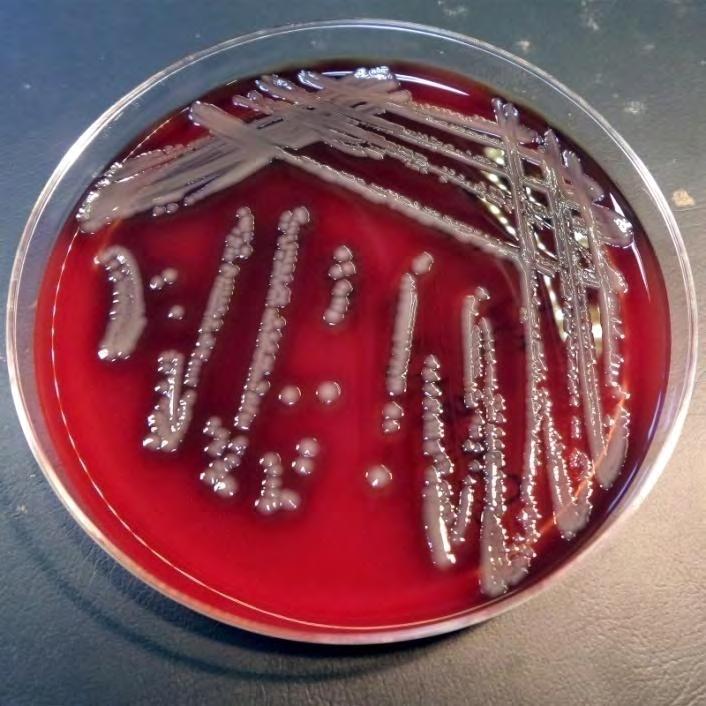 σχετίζεται με καρκινοειδή, αν και το Α. hydrophila έχει απομονωθεί από γαρίδες. Το Α. hydrophila είναι σε θέση να αναπτύσσεται ικανοποιητικά σε θερμοκρασίες ψύξης (0-2 C).