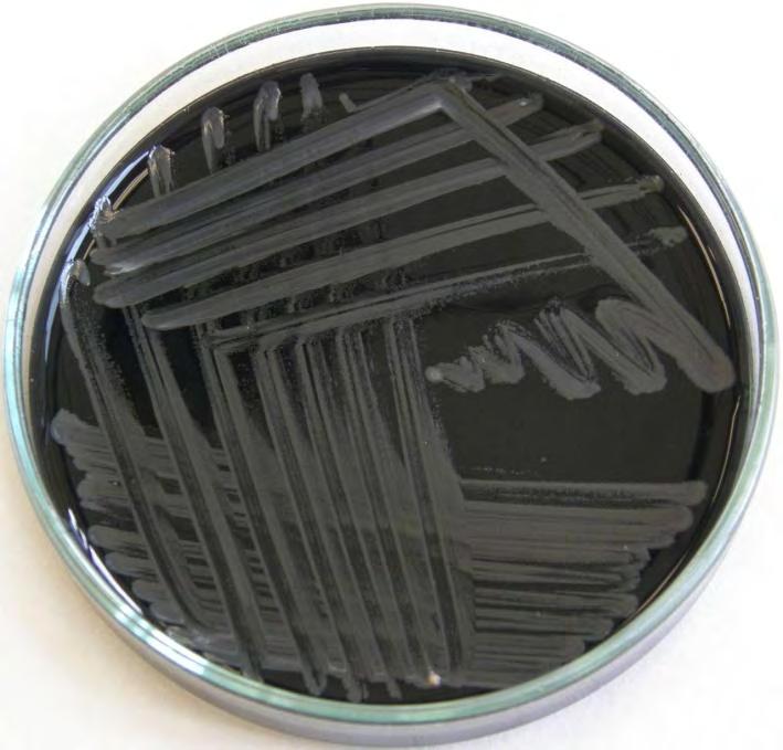 Εικόνα 3.8 Campylobacter spp. καλλιεργημένο σε τρυβλίο Petri (http 7) 4.