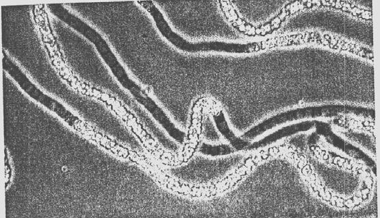 Nitrococcus oceani (διάμετρος κυττάρου 2 μm