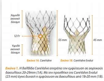 CoreValve Evolut R Tailored height and fit Optimized radial force Coaptation in non-circular anatomy