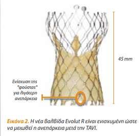 CoreValve Evolut R