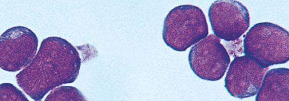Αρχέγονα πολυδύναμα αιμοποιητικά κύτταρα (stem cells) Μικρή δεξαμενή 1-2 Χ 10 6 / άτομο Μεγαλύτερη αντοχή σε βλαπτικά