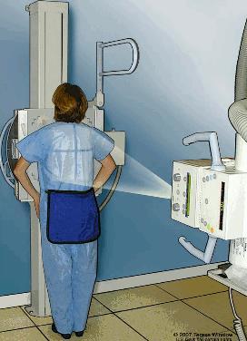 ΘΏΡΑΚΟΣ ΟΠ Κατά τη διάρκεια της ακτινογραφικής εξέτασης του θώρακα, ο ασθενής στέκεται όρθιος μπροστά στον ορθοστάτη.