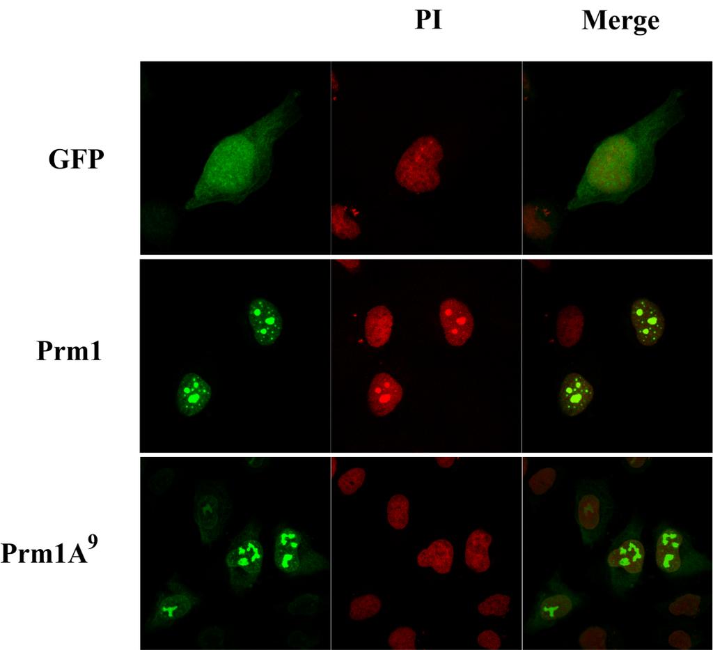 Σχήμα Γ.33. Φθορισμός GFP, Prm1-GFP και Prm1(9A)-GFP μετά από υπερέκφρασή τους σε HeLa κύτταρα. Όπως φαίνεται στο σχήμα Γ.33 η πρωταμίνη 1 εντοπίζεται σε εστίες στον πυρήνα.