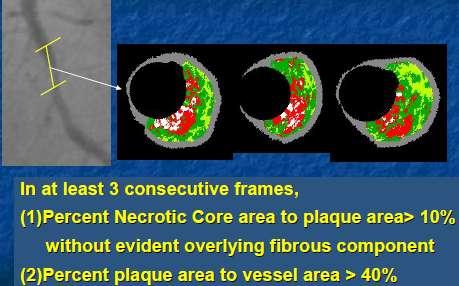 Virtual Histology Οριζμός