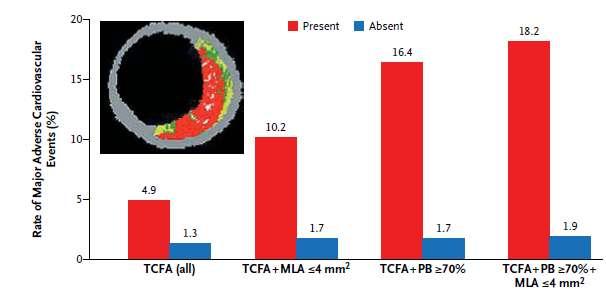 Μελέηη PROSPECT: VH-TCFA υρ ππογνυζηικόρ δείκηηρ ζε επίπεδο βλάβηρ + μεγάλη πλάκα + μικρός