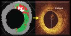 Sawada et al, EHJ (2008)