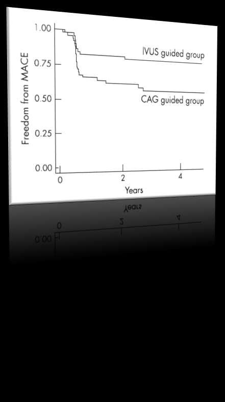 Long term clinical effects in IVUS guided PCI Number of MACE is significantly lower in the IVUS guided group than in the angiography (CAG) group, mainly because there were fewer