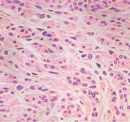 22 3) Οι λείοι μύες αποτελούνται από συλλογές ατρακτοειδών κυττάρων που δεν εμφανίζουν γραμμώσεις. Η διαδικασία συστολής τους είναι βραδεία και δεν υπόκειται στον έλεγχο της βούλησης (εικ.9).