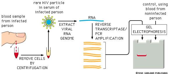 Aνίχνευση HIV με RT-PCR δείγμα αίματος από μολυσμένο άτομο ελάχιστα ιοσωμάτια HIV στον ορό του μολυσμένου ατόμου Εκχύλιση του ιικού RNA γονιδιώματος