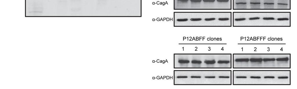 έκφραση της πρωτεΐνης CagA (Εικόνα 12Β) (126).