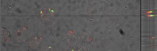 επιθηλιακών κυττάρων και της φωσφορυλίωσης