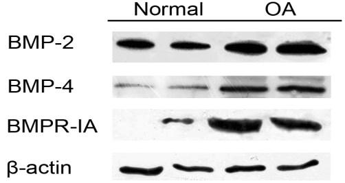 Η έκφραση της BMP-7 και του υποδοχέα BMPR-IB δεν παρουσίασε σημαντική διαφορά μεταξύ φυσιολογικών και ΟΑ χονδροκυττάρων (Εικόνα 16α).