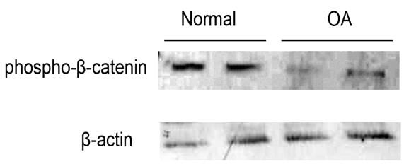 Προκειμένου να επιβεβαιωθεί η αυξημένη ενεργοποίηση του σηματοδοτικού μονοπατιού Wnt/β-κατενίνης στα ΟΑ χονδροκύττρα, προσδιορίστηκαν τα πρωτεϊνικά επίπεδα έκφραση της φωσφορυλιωμένης β-κατενίνης