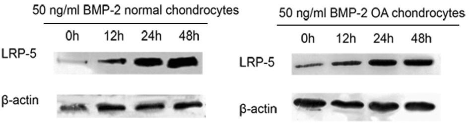 12, 24 και 48 ώρες. *p<0.05. (β) Απεικόνιση των πρωτεϊνικών επιπέδων τoυ LRP-5 σε καλλιέργειες φυσιολογικών και ΟΑ χονδροκυττάρων μετά από επίδραση με 50 ng/ml ΒΜΡ-2 για 12, 24 και 48 ώρες.