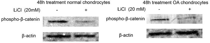 κατενίνης με τη χορήγηση LiCl σε καλλιέργειες φυσιολογικών και ΟΑ χονδροκυττάρων.