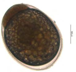 117 Εικόνα 3.5: Στάδιο του μοριδίου (6 h & 50 min) του A.nigrofasciatus (Πηγή: Προσωπικό αρχείο).