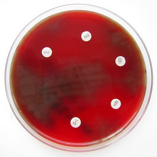 Ispitivanje osetljivosti na makrolidne antibiotike Procena osetljivosti pneumokoka na makrolide se može izvršiti testiranjem osetljivosti na eritromicin.