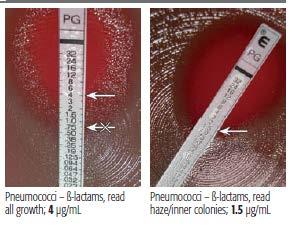 Slika 13. Određivanje vrednosti MIK cefotaksima za pneumokok, pomoću trake M.I.C. evaluator (Oxoid), koji je ekvivalentan E testu (biomerieux) Slika 14.