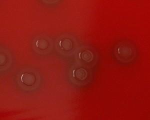 Slika 3. Izgled kolonija Streptococcus pneumoniae na krvnom agaru.