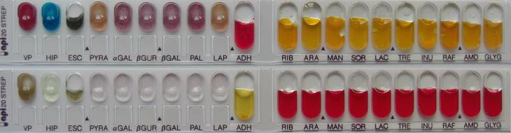 U našoj sredini su to API 20 Strep i Rapid ID 32 Strep, koji prve rezultate daje posle 4 sata inkubacije, a konačne posle 24 sata (slika 9).