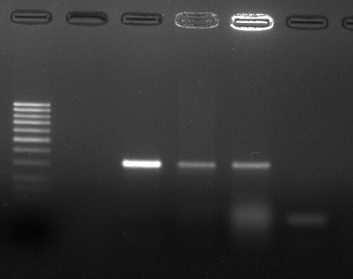 Postoji komercijalna proba AccuProbe Pneumococcus, koja bazira na detekciji specifične ribozomalne RNK sekvence.