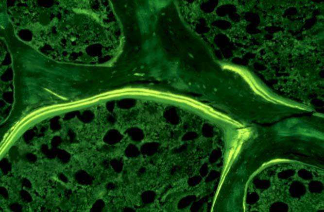 Ibandronate biopsies 8 microct και