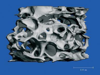 Calcif Tissue Int 7;8(Suppl.