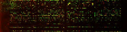 Lymphoma/Leukemia Molecular Profiling Project (LLMPP) µπορούν να κατηγοριοποιηθούν σε δύο οµάδες µικροσυστοιχιών.