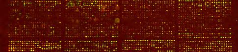 Lymphoma/Leukemia Molecular Profiling Project. Α.2.