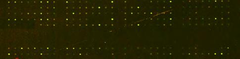 3 Young_vs_Old_Transgenic βάση