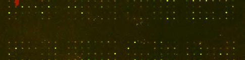 Young_vs_Old_Transgenic