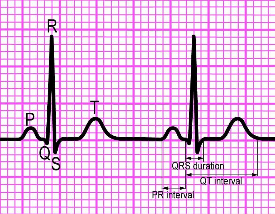 QRS