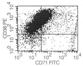 CD3-, Pan-Β (-).