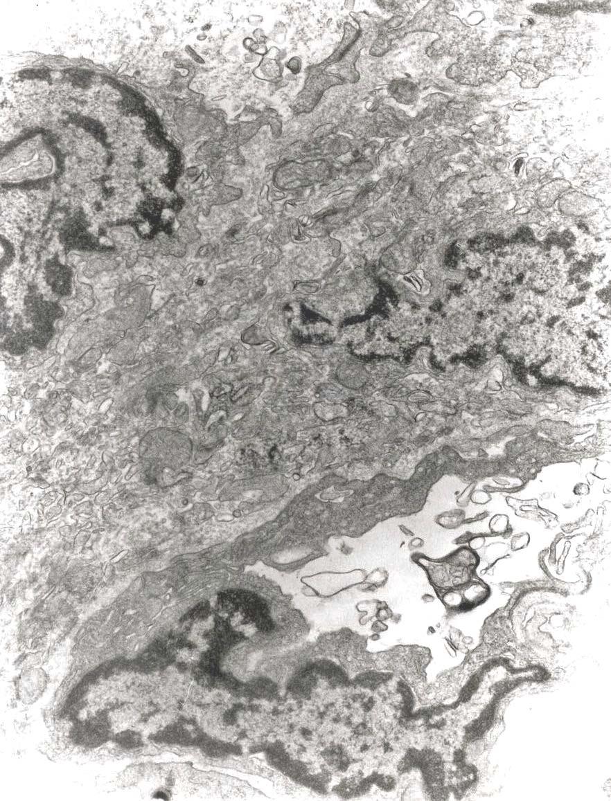 Εικόνα 11. Ομάδα 1. Τριχοειδές αγγείο με ενδοθήλιο που εμφανίζει έντονη λειτουργικότητα με πολλά μεταφορικά κυστίδια.