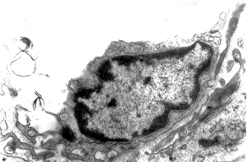 μεσεγχυματικά κύτταρα (αρχική μεγέθυνση Χ 6000). Εικόνα 27.