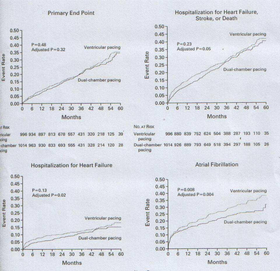 Ventricular pacing or