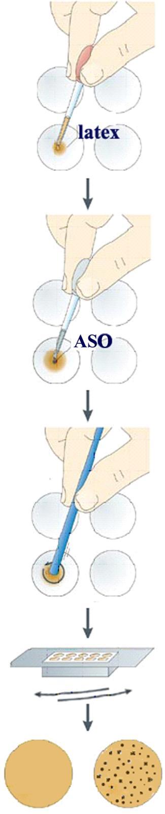 ASO LATEX Στην μέθοδο αυτή χρησιμοποιούνται σωματίδια latex τα οποία είναι καλυμμένα με στρεπτολυσίνη-ο.