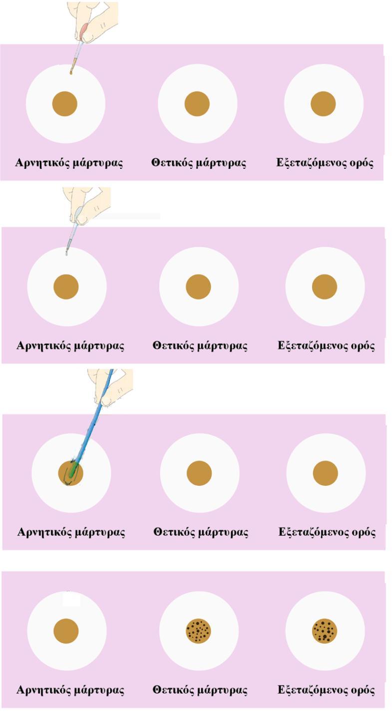 Μέθοδοι ανίχνευσης Latex (ποιοτικός και ημι-ποσοτικός προσδιορισμός) Νεφελομετρία (ποσοτικός προσδιορισμός) C-αντιδρώσα πρωτεΐνη Latex (ποιοτικός προσδιορισμός) Βάζουμε σε μια αντικειμενοφόρο πλάκα: