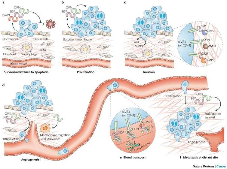 Οστεοποντίνη - καρκίνος OPN as a target for cancer