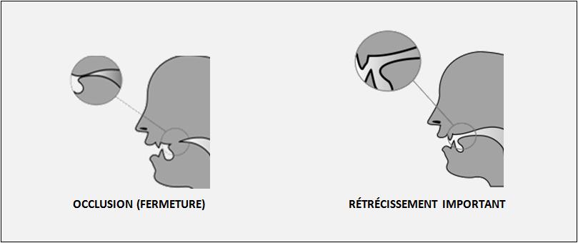 3.4 Classification des sons (2/2) Les consonnes se distinguent des voyelles en ce qu elles sont produites