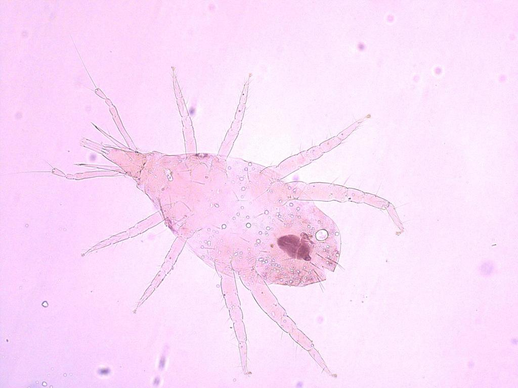 Εικόνα Π.Ι Ι.9. Biscirus sp., Bdellidae (Βρέθηκε την 21.