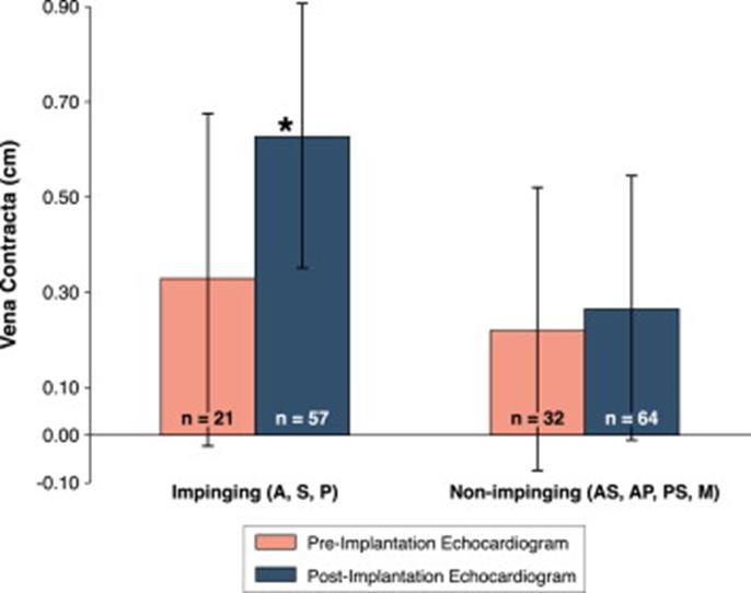 Device Lead Locations on 3D Transthoracic Echocardiography(A) Three-dimensional (3D) zoom examples of