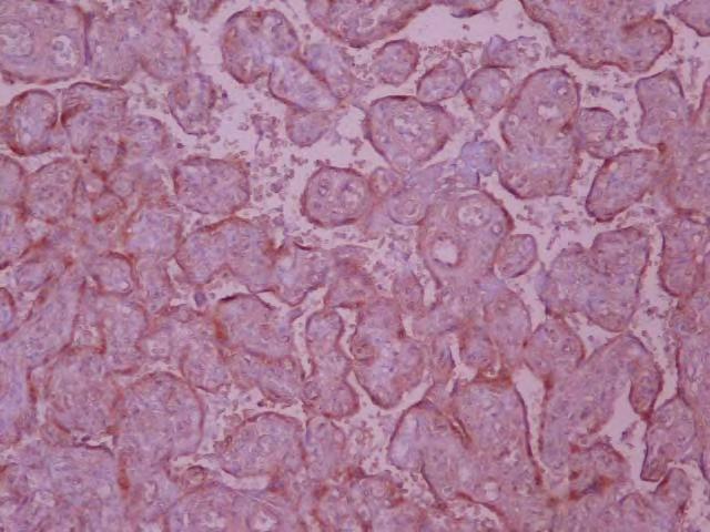 Εικόνα A.3. Ασθενής χρώση του VEGF Ανοσοϊστοχημική μελέτη του VEGF σε κυτταροτροφοβλάστη από φυσιολογικό πλακούντα.