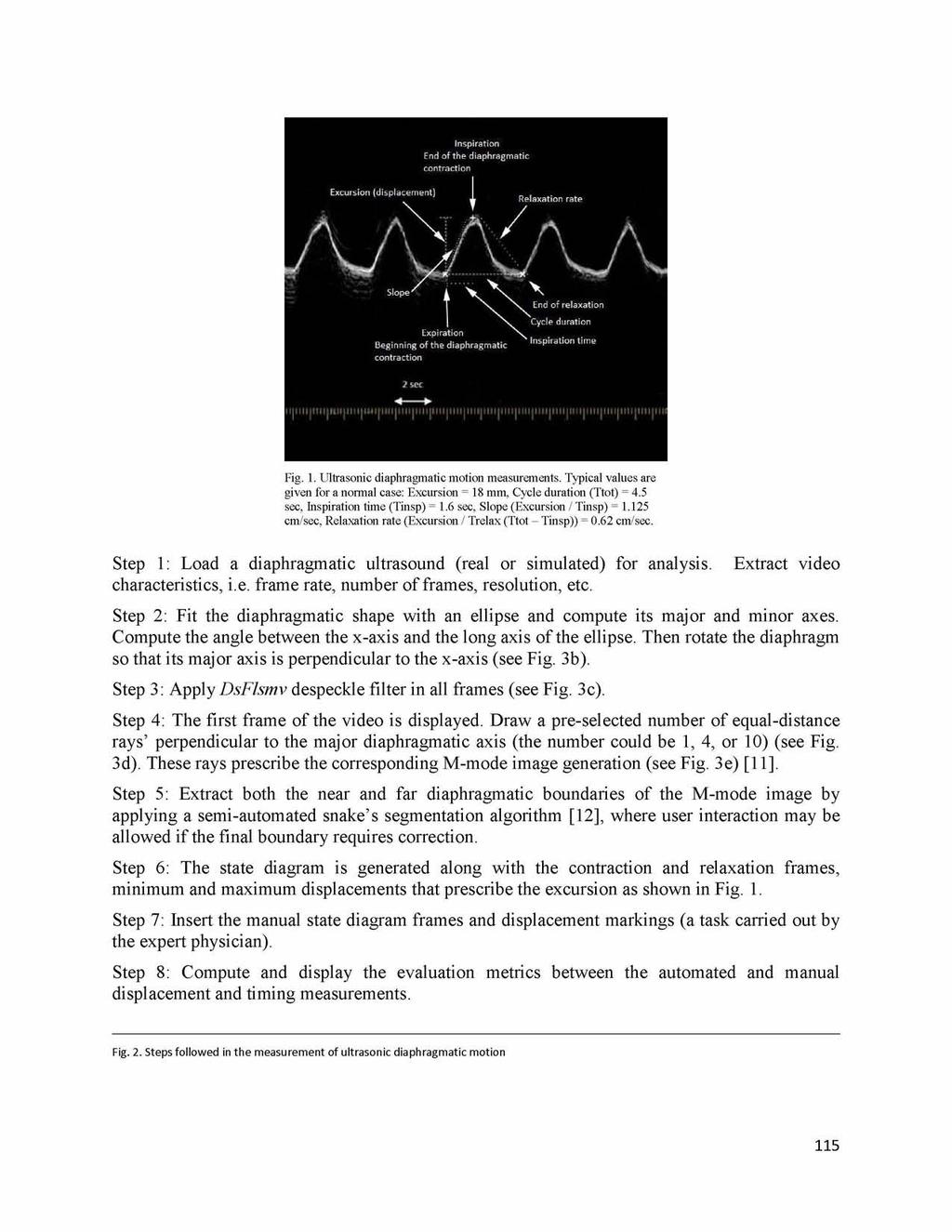 Fig. 1. Ultrasonic diaphragmatic motion measurements. Typical values are given for a normal case: Excursion = 18 mm, Cycle duration (Ttot) = 4.5 sec, Inspiration time (Tinsp) = 1.