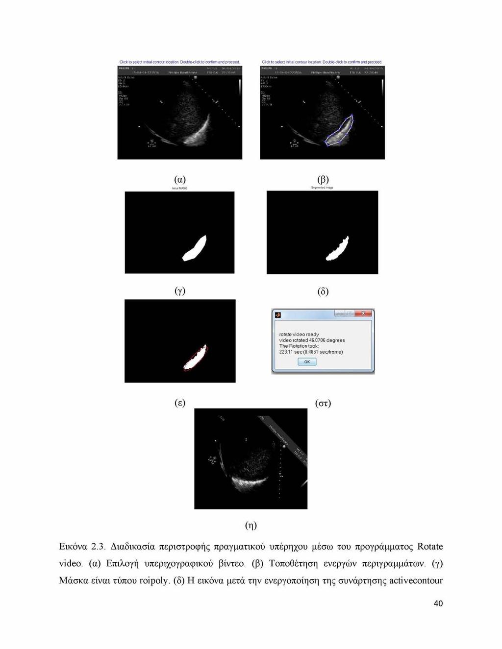 Click to select initial contour location. Double-cNck to confirm and proceed. (δ) (ε) (στ) (η) Εικόνα 2.3.